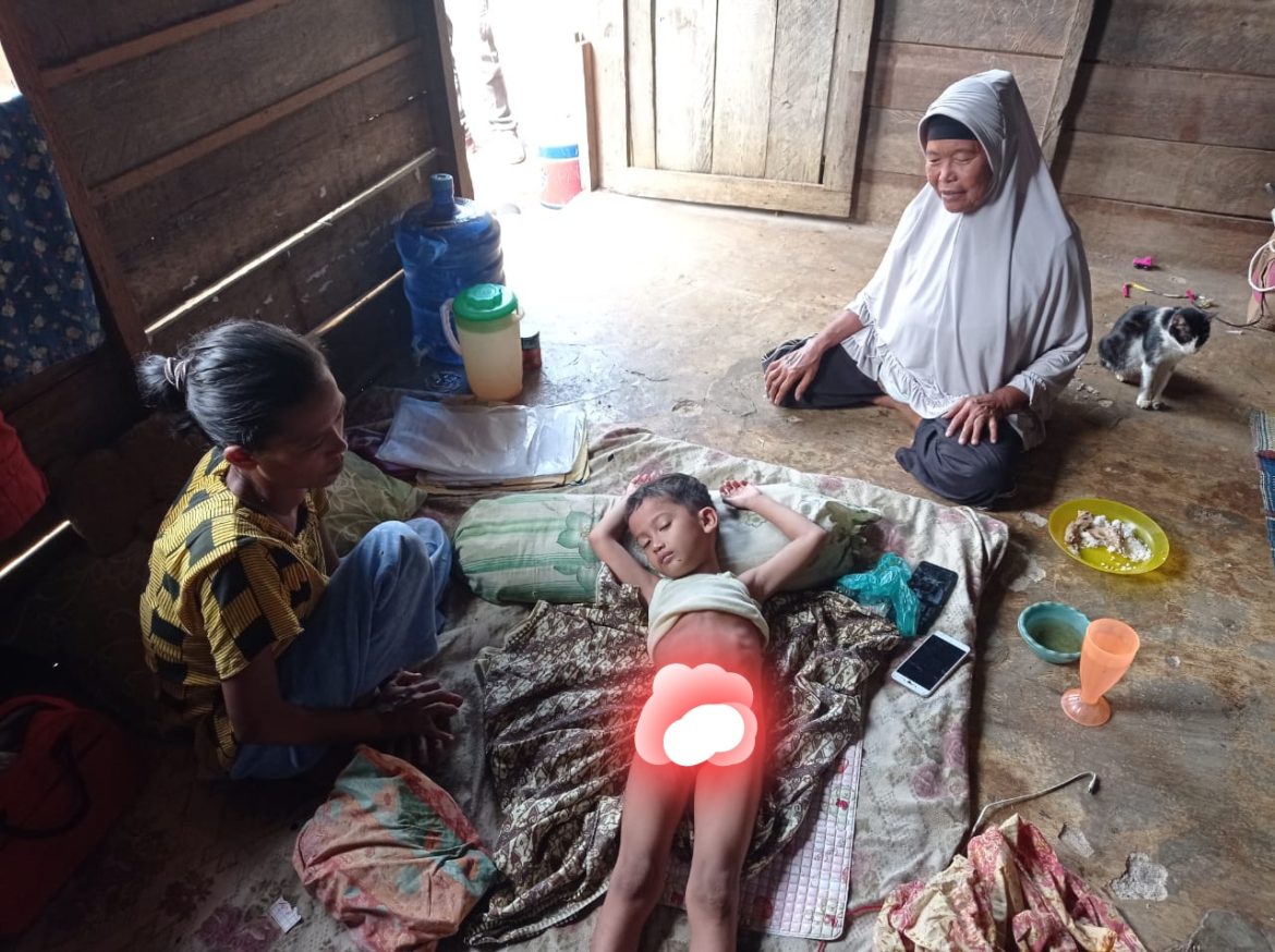 Butuh Biaya Perobatan Anaknya, Pasutri di Sidimpuan Butuh Uluran Tangan